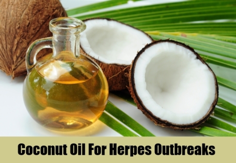 Coconut-Oil-For-Herpes-Outbreaks